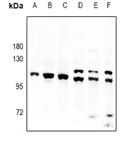 WB - Anti-PAP Antibody AP61057